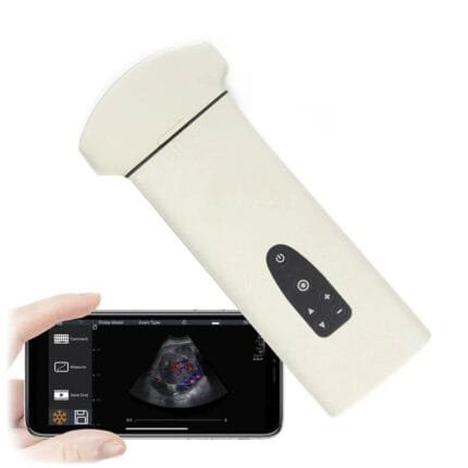 Ecógrafo YouKey D8 Vet Ultrasound System